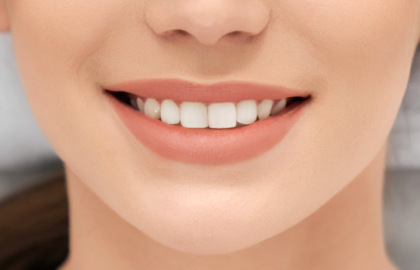 Estetica dentale: quali trattamenti scegliere in base alle proprie esigenze